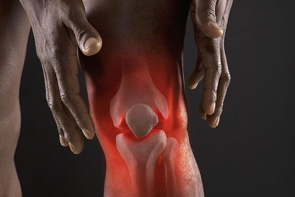 Symptômes d'arthrose