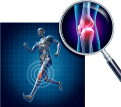 arthrose de l'articulation du genou